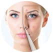 Pimple and Scar removal Treatment