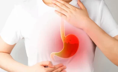 Hyper acidity in ayurveda