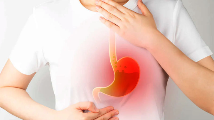 Hyper acidity in ayurveda