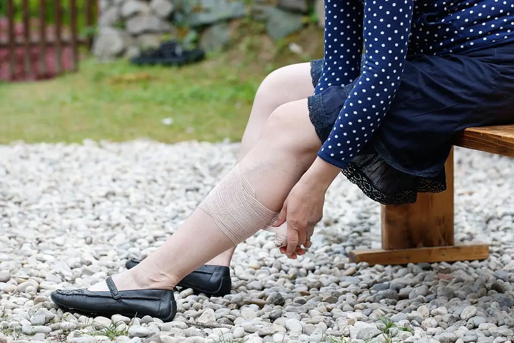 Tired Legs and Painful Ulcers? Discover Ayurvedic Relief for Varicose Ulcers