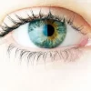 Ayurvedic remedies for common eye disorders